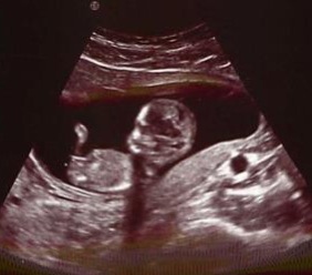 Eliana in the womb.